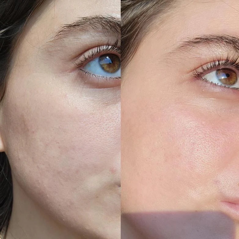 Load image into Gallery viewer, Eco By Sonya Driver Serum of Clear 30 ml